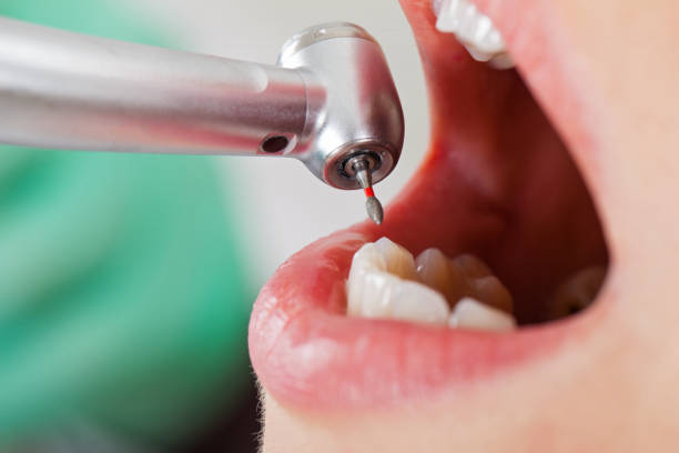 Best Emergency Dental Care for Sports Injuries in Bartonville, TX
